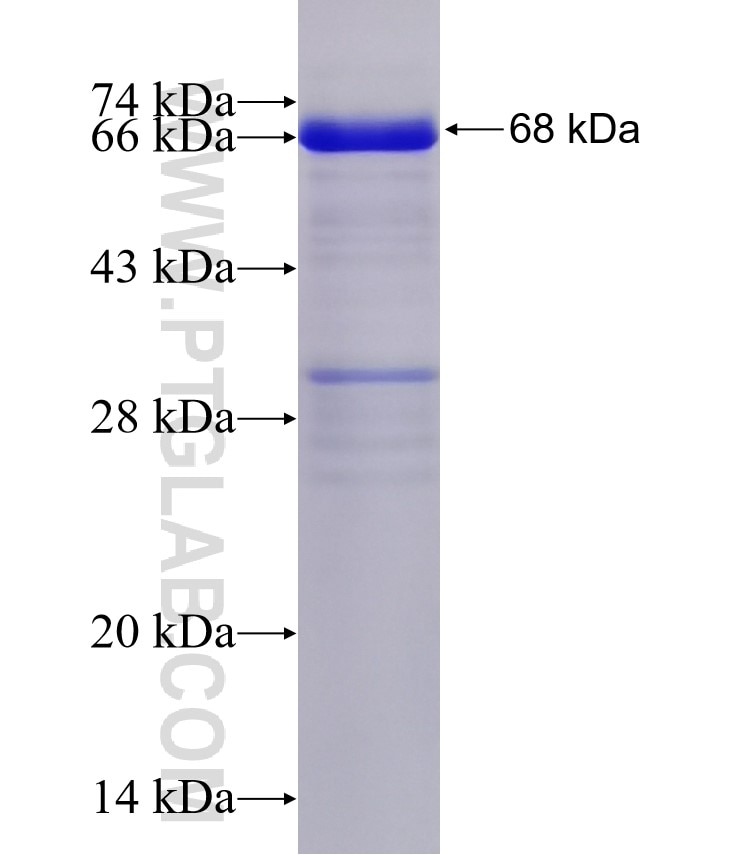RIOK2 fusion protein Ag9975 SDS-PAGE