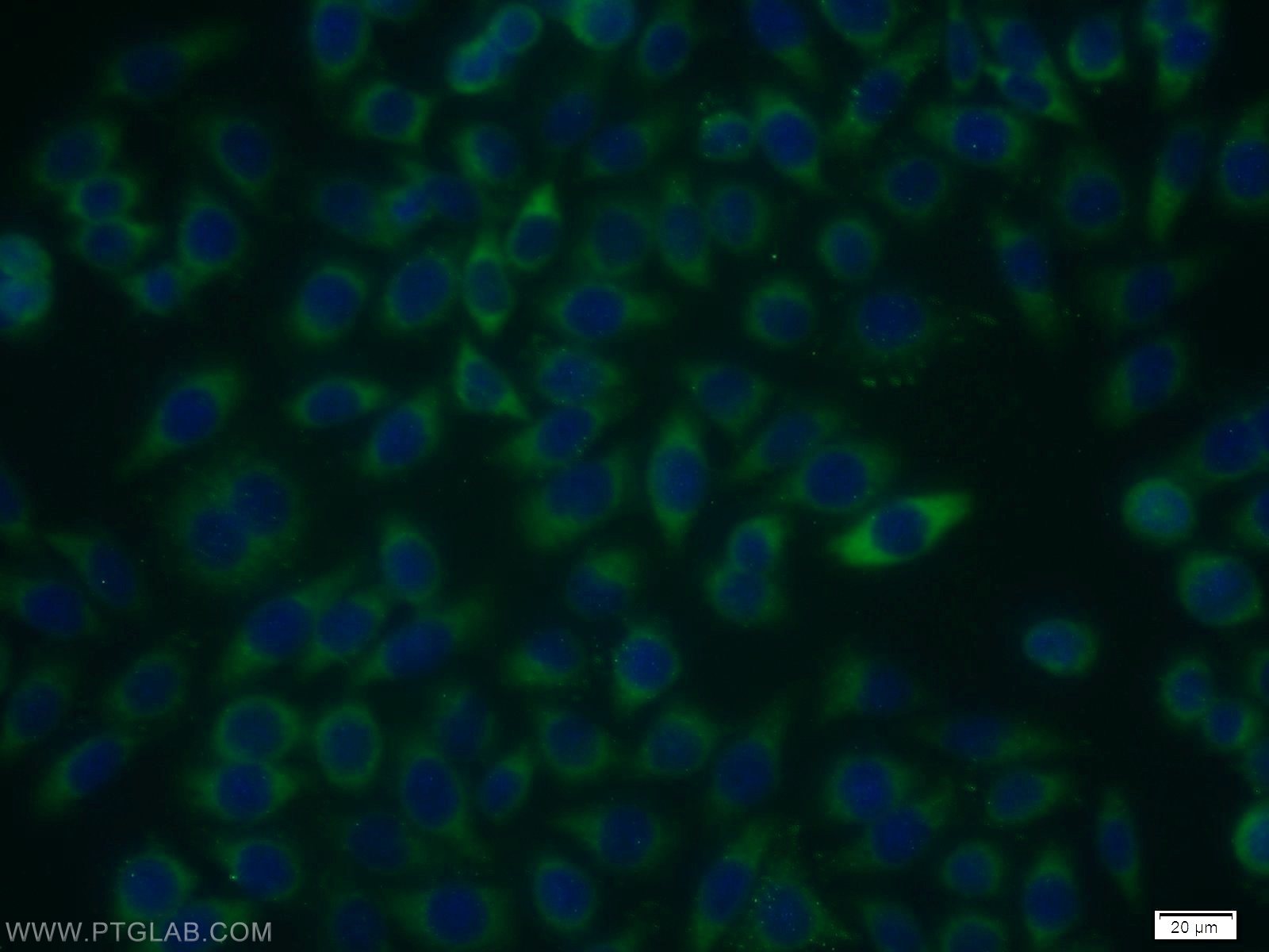 Immunofluorescence (IF) / fluorescent staining of MCF-7 cells using RIOK3 Polyclonal antibody (13593-1-AP)