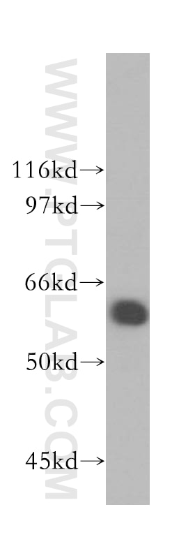 Western Blot (WB) analysis of mouse testis tissue using RIOK3 Polyclonal antibody (13593-1-AP)
