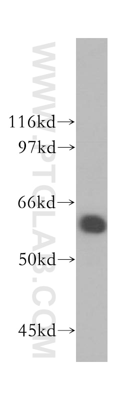 WB analysis of mouse testis using 13593-1-AP