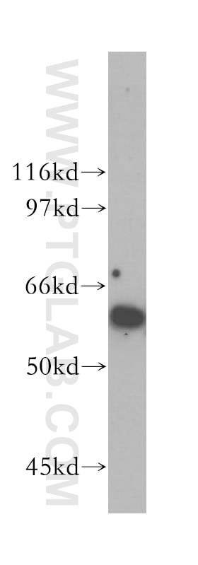 Western Blot (WB) analysis of MCF-7 cells using RIOK3 Polyclonal antibody (13593-1-AP)