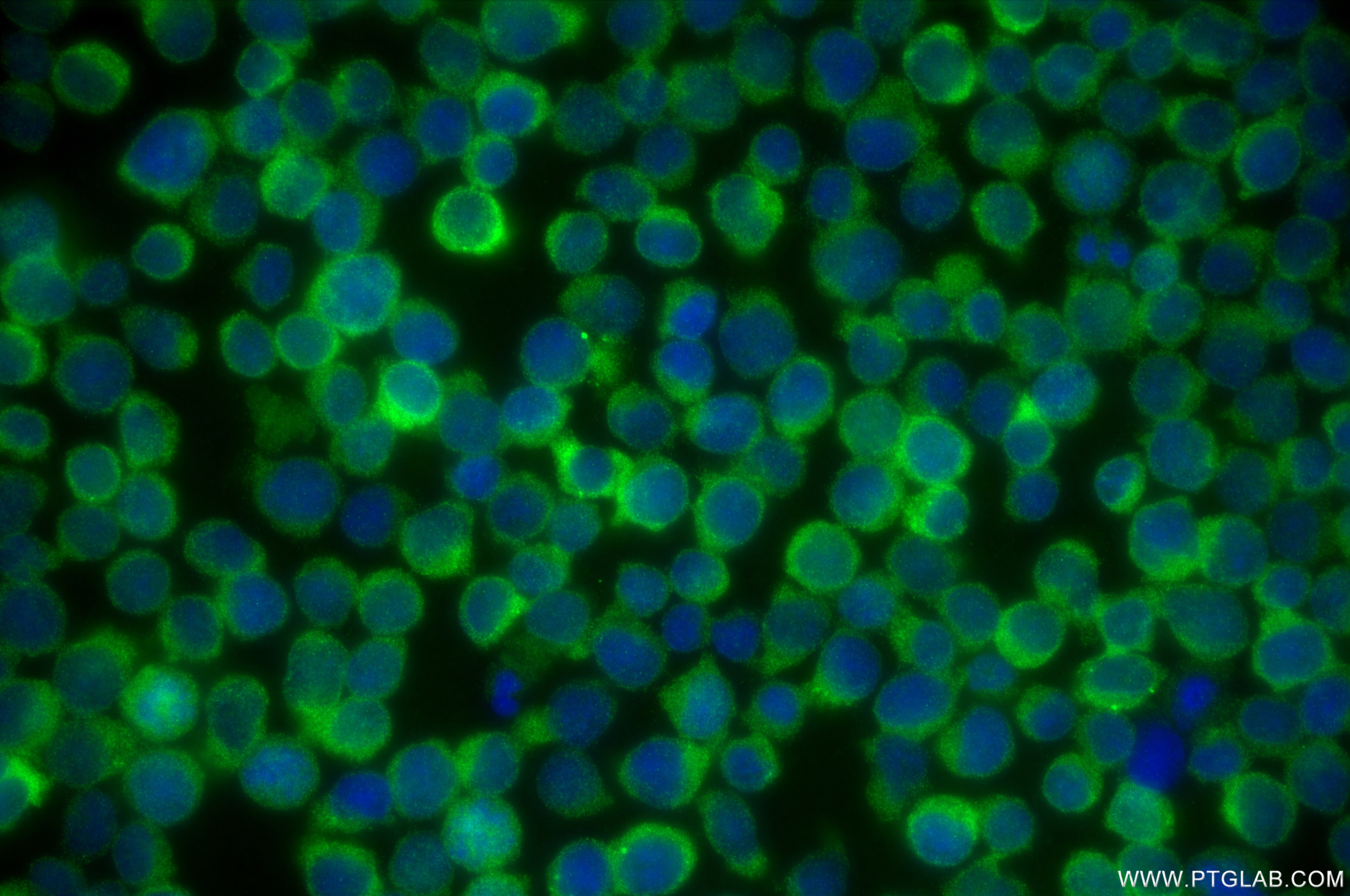 Immunofluorescence (IF) / fluorescent staining of Jurkat cells using RIOK3 Recombinant antibody (85449-5-RR)