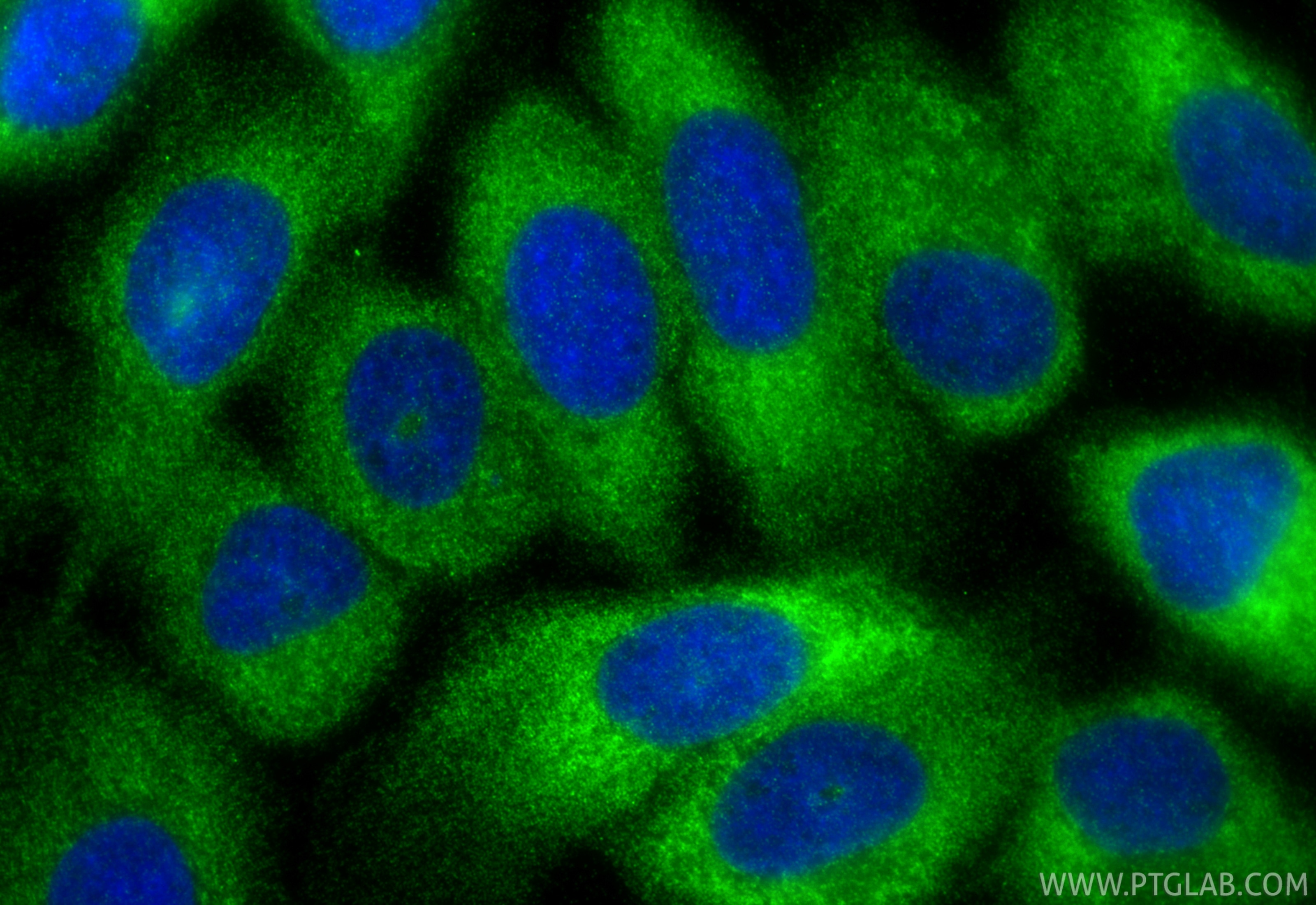 Immunofluorescent analysis of (-20°C Methanol) fixed A431 cells using RIOK3 antibody (85449-5-RR, Clone: 242996A6 ) at dilution of 1:400 and CoraLite®488-Conjugated Goat Anti-Rabbit IgG(H+L) (SA00013-2). Immunofluorescence (IF) / fluorescent staining of A431 cells using RIOK3 Recombinant monoclonal antibody (85449-5-RR)