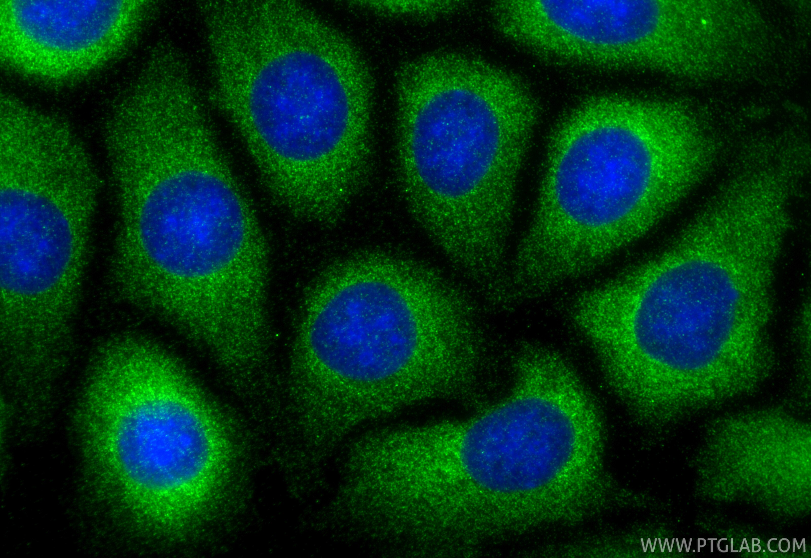 Immunofluorescent analysis of (-20°C Methanol) fixed MCF-7 cells using RIOK3 antibody (85449-5-RR, Clone: 242996A6 ) at dilution of 1:400 and CoraLite®488-Conjugated Goat Anti-Rabbit IgG(H+L) (SA00013-2). Immunofluorescence (IF) / fluorescent staining of MCF-7 cells using RIOK3 Recombinant monoclonal antibody (85449-5-RR)