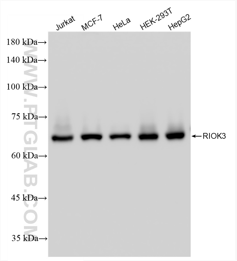 Western Blot (WB) analysis of various lysates using RIOK3 Recombinant antibody (85449-5-RR)