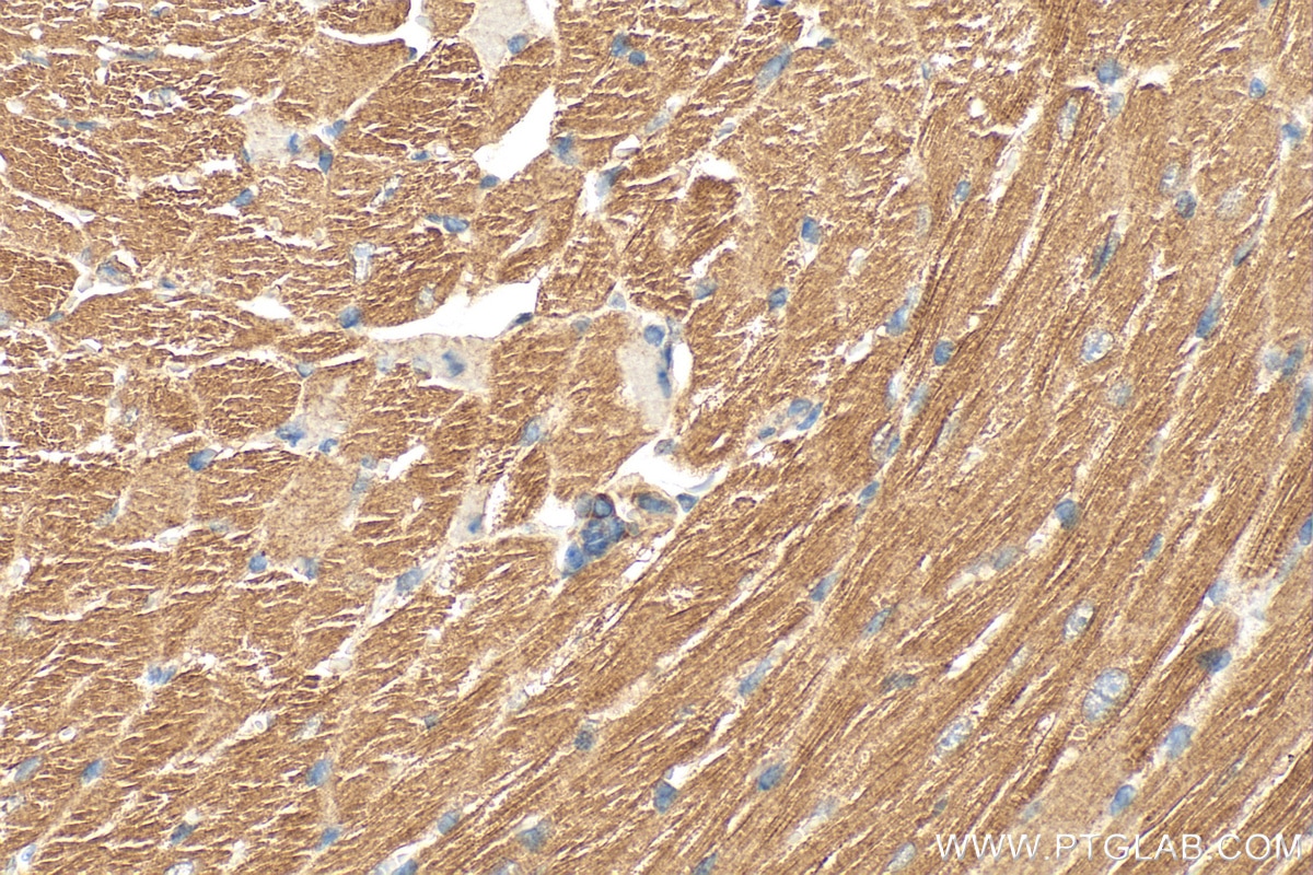 Immunohistochemistry (IHC) staining of mouse heart tissue using RIPK1 Polyclonal antibody (29932-1-AP)
