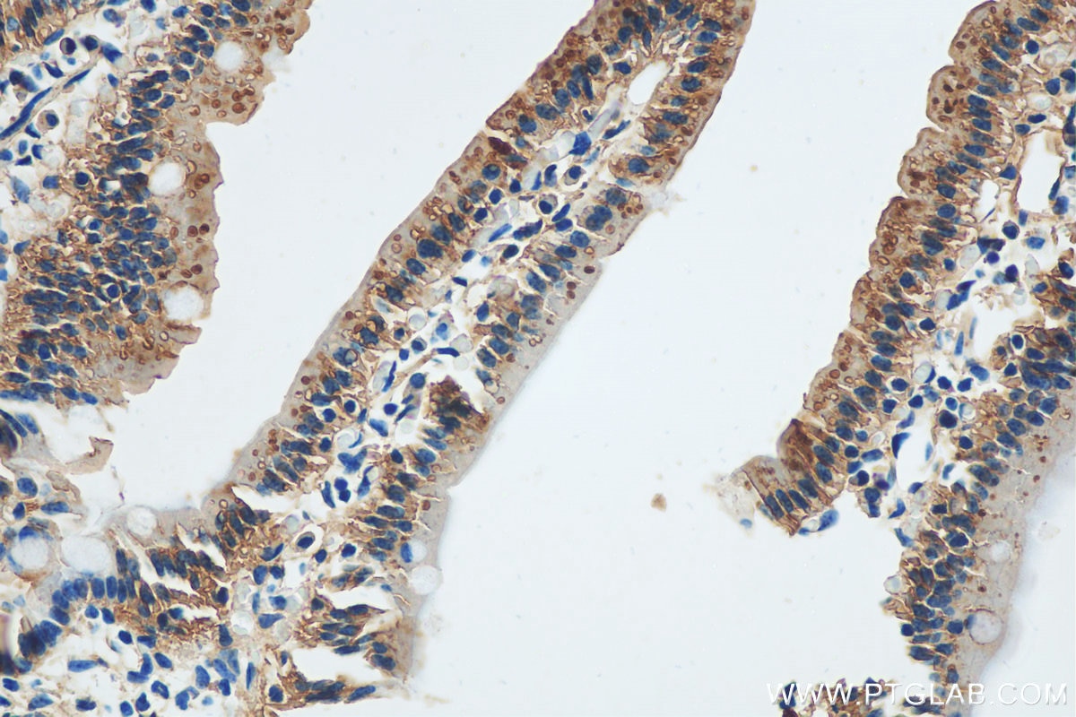 Immunohistochemistry (IHC) staining of mouse small intestine tissue using RIPK1-Specific Polyclonal antibody (17519-1-AP)