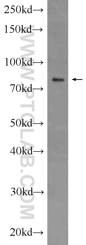 Western Blot (WB) analysis of rat liver tissue using RIPK1-Specific Polyclonal antibody (17519-1-AP)