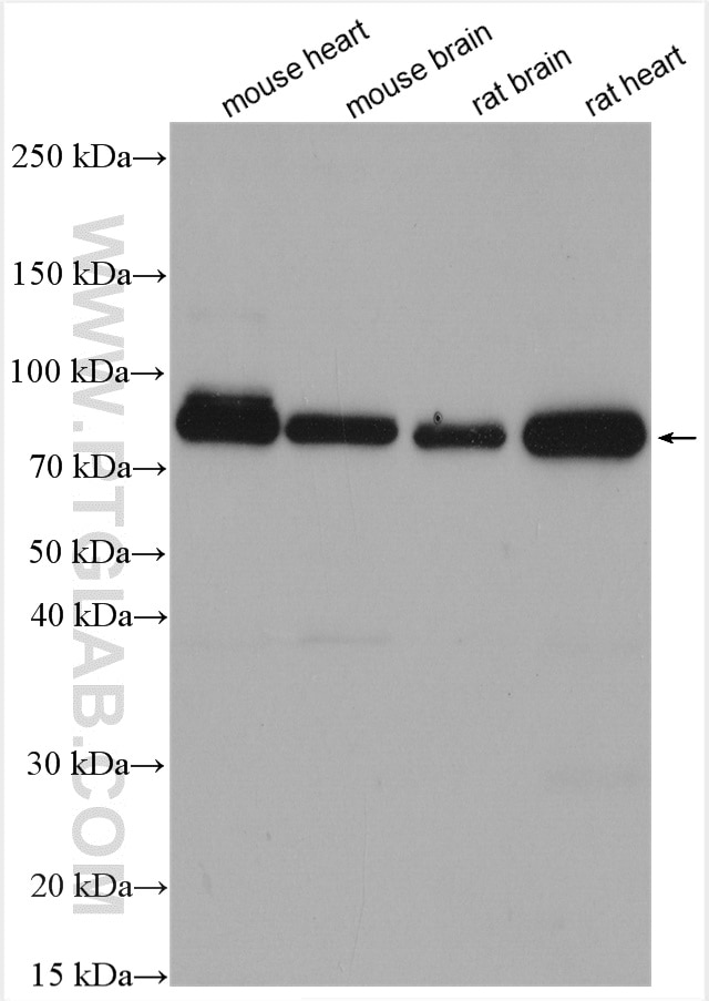 Western Blot (WB) analysis of various lysates using RIPK1-Specific Polyclonal antibody (17519-1-AP)