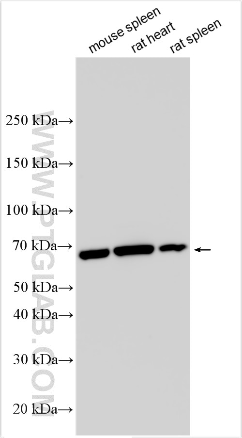 Western Blot (WB) analysis of various lysates using RIPK1-Specific Polyclonal antibody (17519-1-AP)