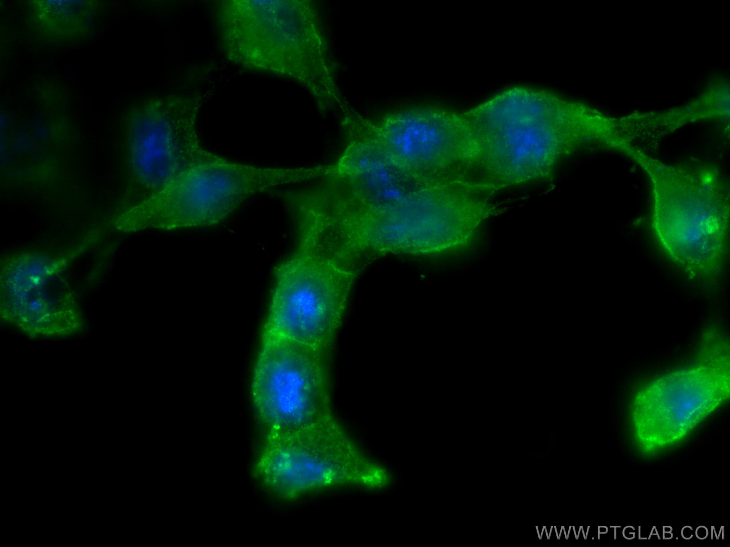 Immunofluorescence (IF) / fluorescent staining of U2OS cells using Phospho-RIPK1 (Ser161)  Monoclonal antibody (66854-1-Ig)