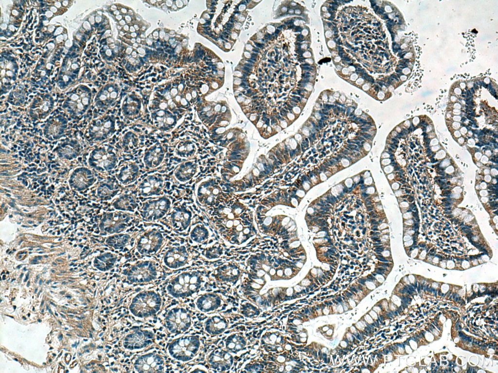 IHC staining of human small intestine using 66854-1-Ig