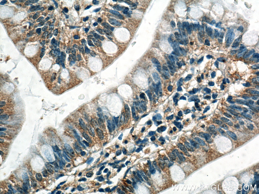 Immunohistochemistry (IHC) staining of human small intestine tissue using Phospho-RIPK1 (Ser161)  Monoclonal antibody (66854-1-Ig)