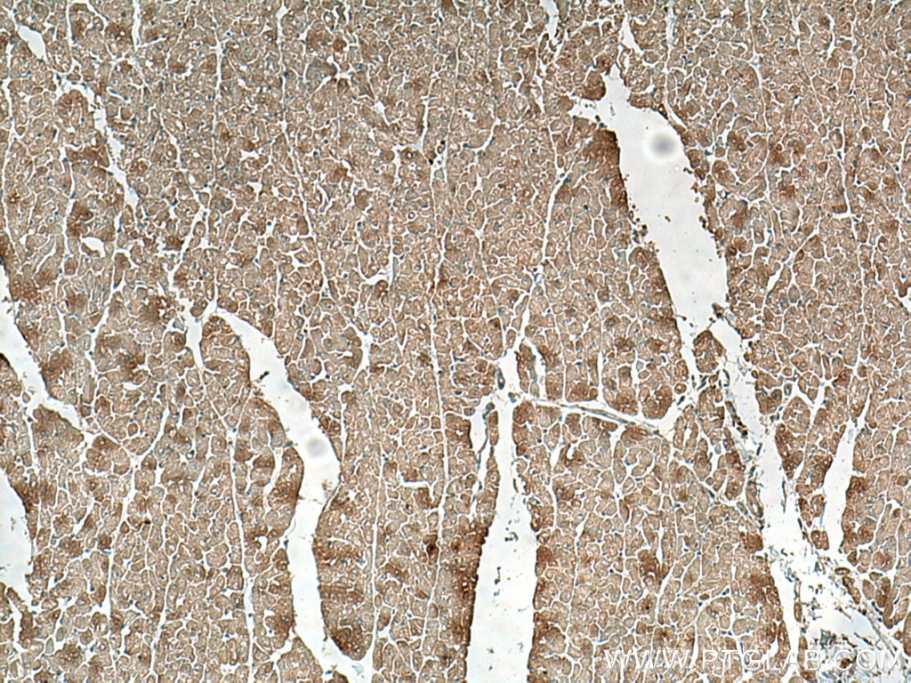 Immunohistochemistry (IHC) staining of human heart tissue using Phospho-RIPK1 (Ser161)  Monoclonal antibody (66854-1-Ig)