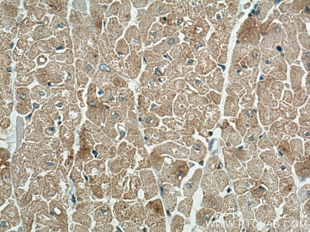 Immunohistochemistry (IHC) staining of human heart tissue using Phospho-RIPK1 (Ser161)  Monoclonal antibody (66854-1-Ig)