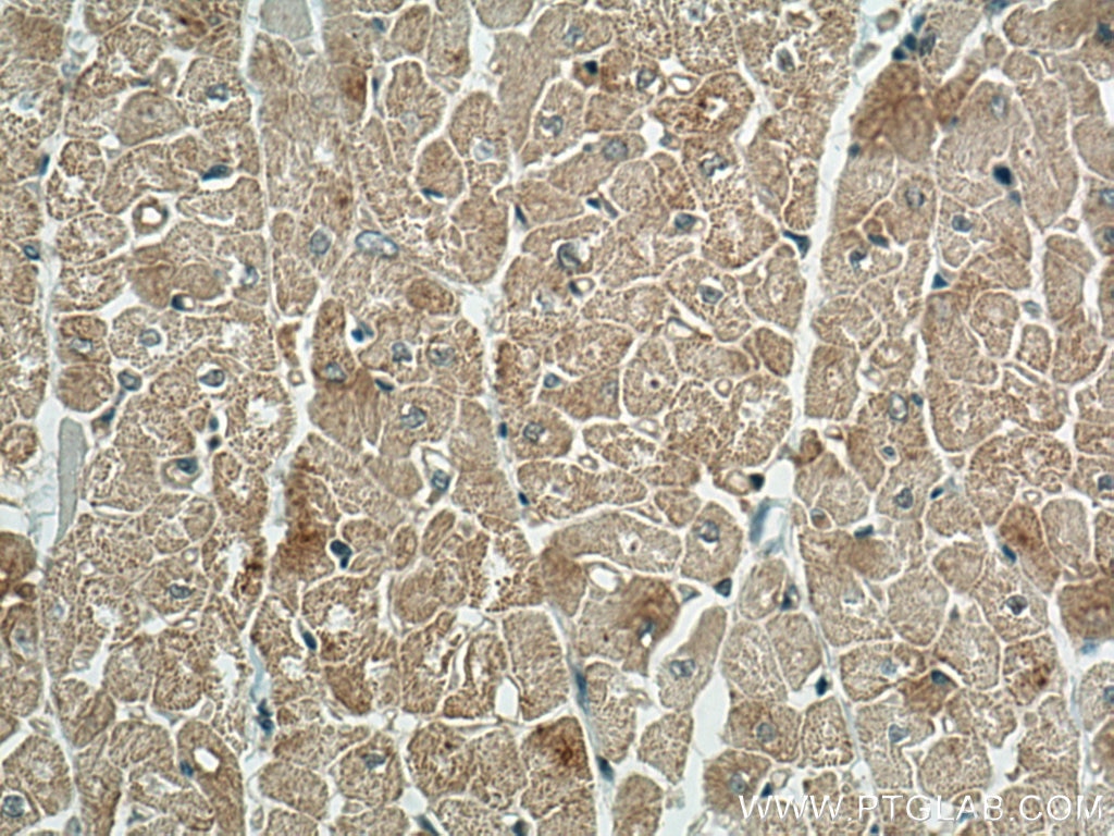 IHC staining of human heart using 66854-1-Ig