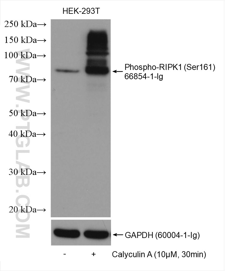 Western Blot (WB) analysis of various lysates using Phospho-RIPK1 (Ser161)  Monoclonal antibody (66854-1-Ig)