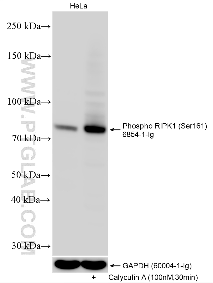 Western Blot (WB) analysis of various lysates using Phospho-RIPK1 (Ser161)  Monoclonal antibody (66854-1-Ig)