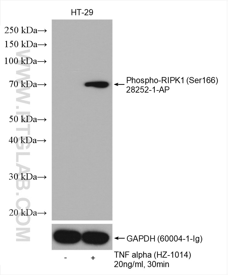 Western Blot (WB) analysis of various lysates using Phospho-RIPK1 (Ser166) Polyclonal antibody (28252-1-AP)