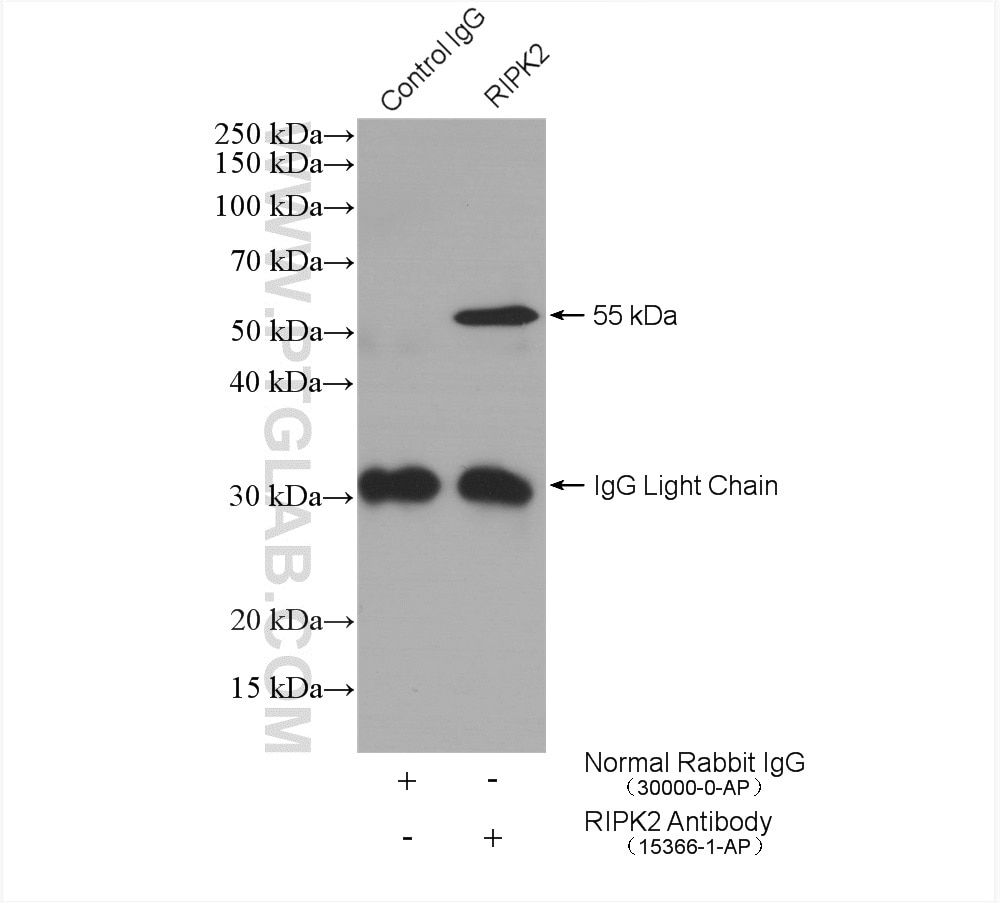 Immunoprecipitation (IP) experiment of HEK-293T cells using RIPK2 Polyclonal antibody (15366-1-AP)