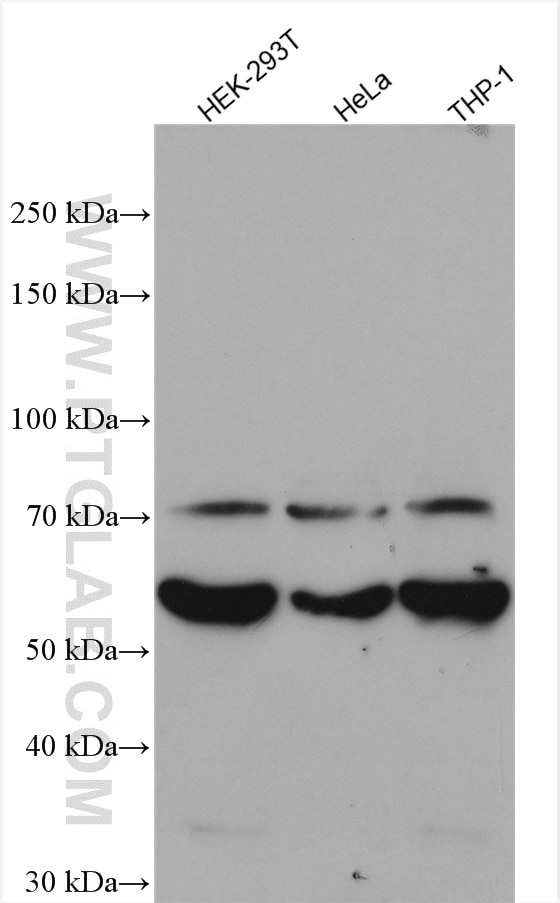Western Blot (WB) analysis of various lysates using RIPK2 Polyclonal antibody (15366-1-AP)
