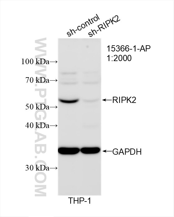 Western Blot (WB) analysis of THP-1 cells using RIPK2 Polyclonal antibody (15366-1-AP)