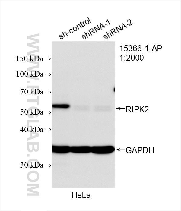 Western Blot (WB) analysis of HeLa cells using RIPK2 Polyclonal antibody (15366-1-AP)