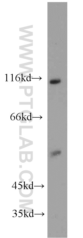 Western Blot (WB) analysis of mouse brain tissue using RIPK2 Polyclonal antibody (15366-1-AP)
