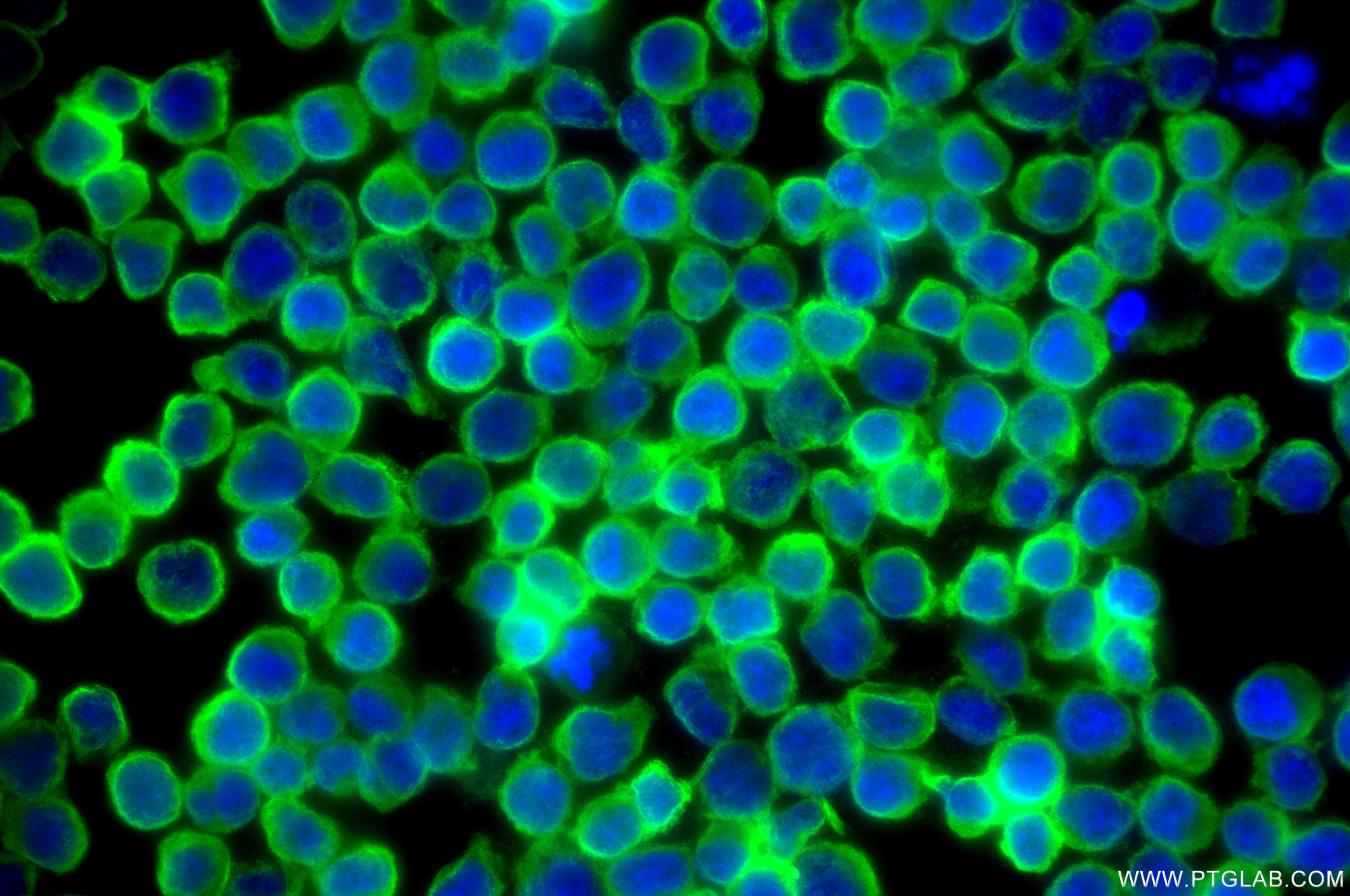 Immunofluorescent analysis of (4% PFA) fixed Jurkat cells using RIPK2 antibody (85760-4-RR, Clone: 250069D9 ) at dilution of 1:400 and CoraLite®488-Conjugated Goat Anti-Rabbit IgG(H+L) (SA00013-2). Immunofluorescence (IF) / fluorescent staining of Jurkat cells using RIPK2 Recombinant monoclonal antibody (85760-4-RR)
