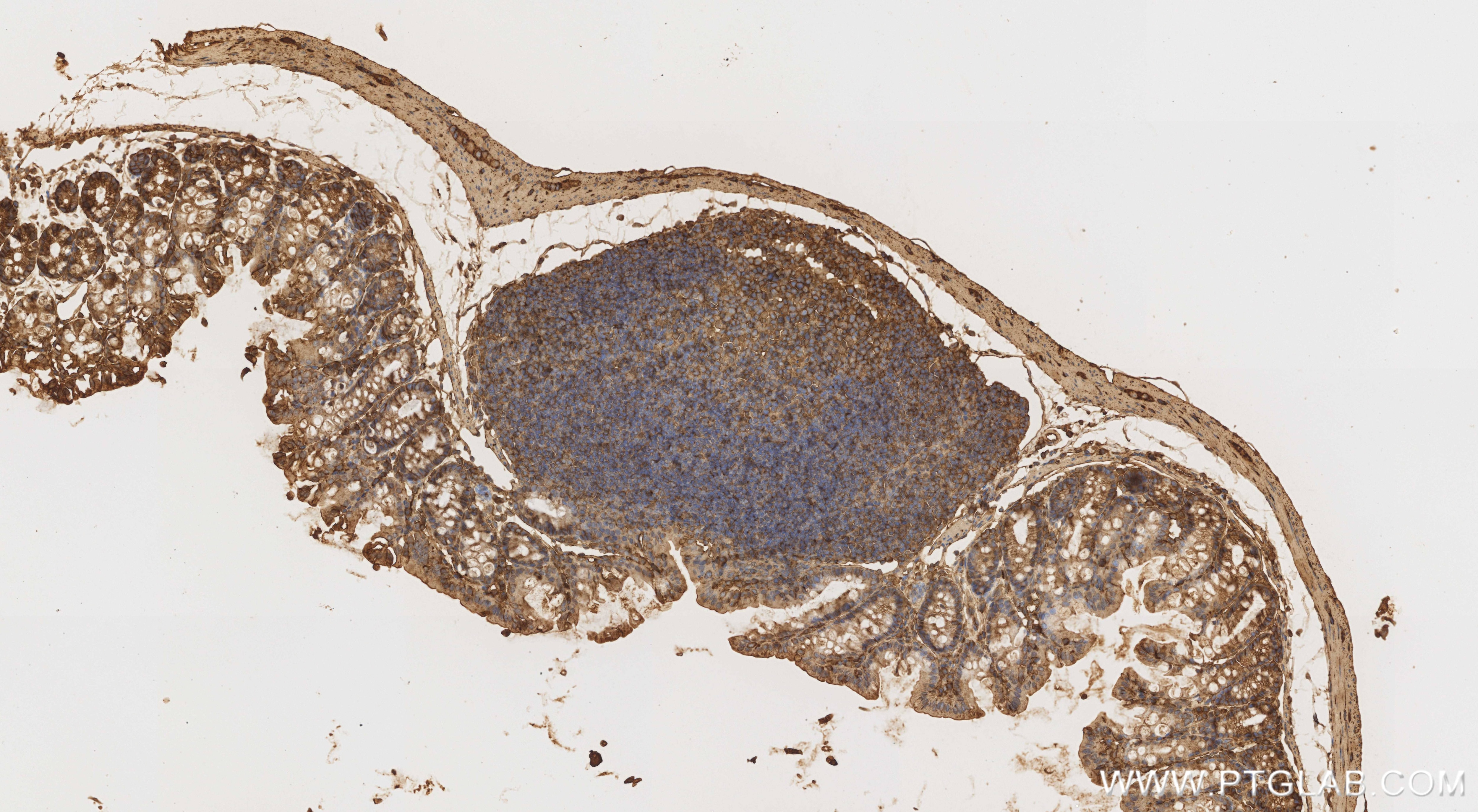 Immunohistochemistry (IHC) staining of mouse colon tissue using RIPK2 Recombinant monoclonal antibody (85760-4-RR)