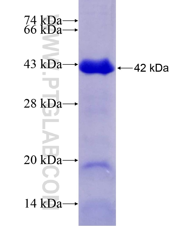RIPK2 fusion protein Ag8276 SDS-PAGE