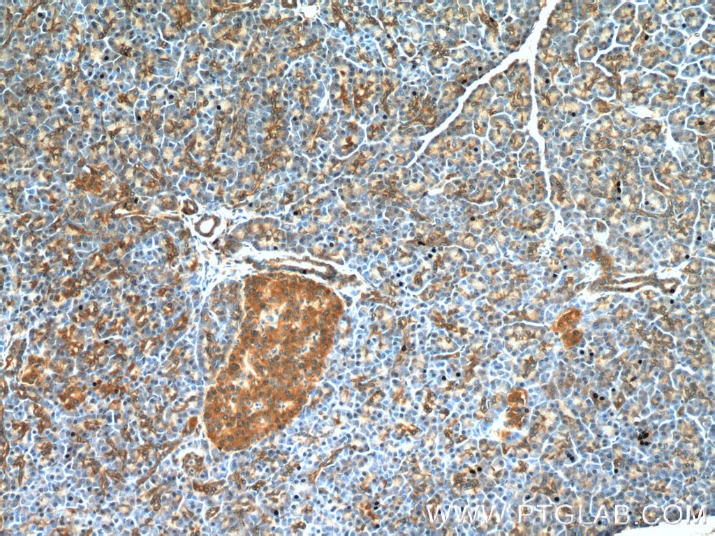 Immunohistochemistry (IHC) staining of human pancreas tissue using RIP3 Polyclonal antibody (17563-1-AP)