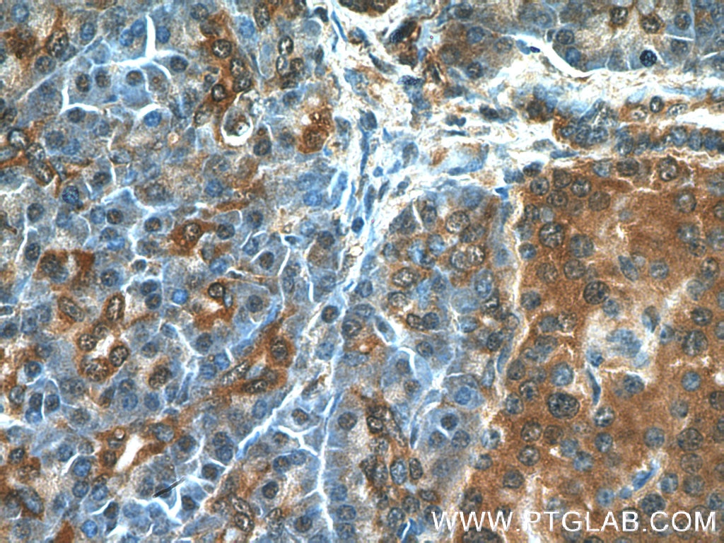 Immunohistochemistry (IHC) staining of human pancreas tissue using RIP3 Polyclonal antibody (17563-1-AP)