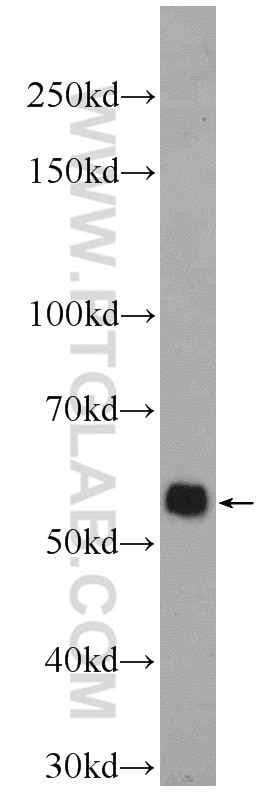 Western Blot (WB) analysis of Jurkat cells using RIP3 Polyclonal antibody (17563-1-AP)