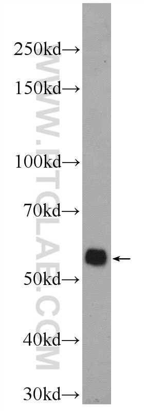 RIP3 Polyclonal antibody