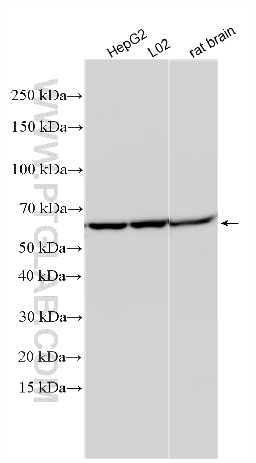 Western Blot (WB) analysis of various lysates using RIPK3 Polyclonal antibody (29080-1-AP)