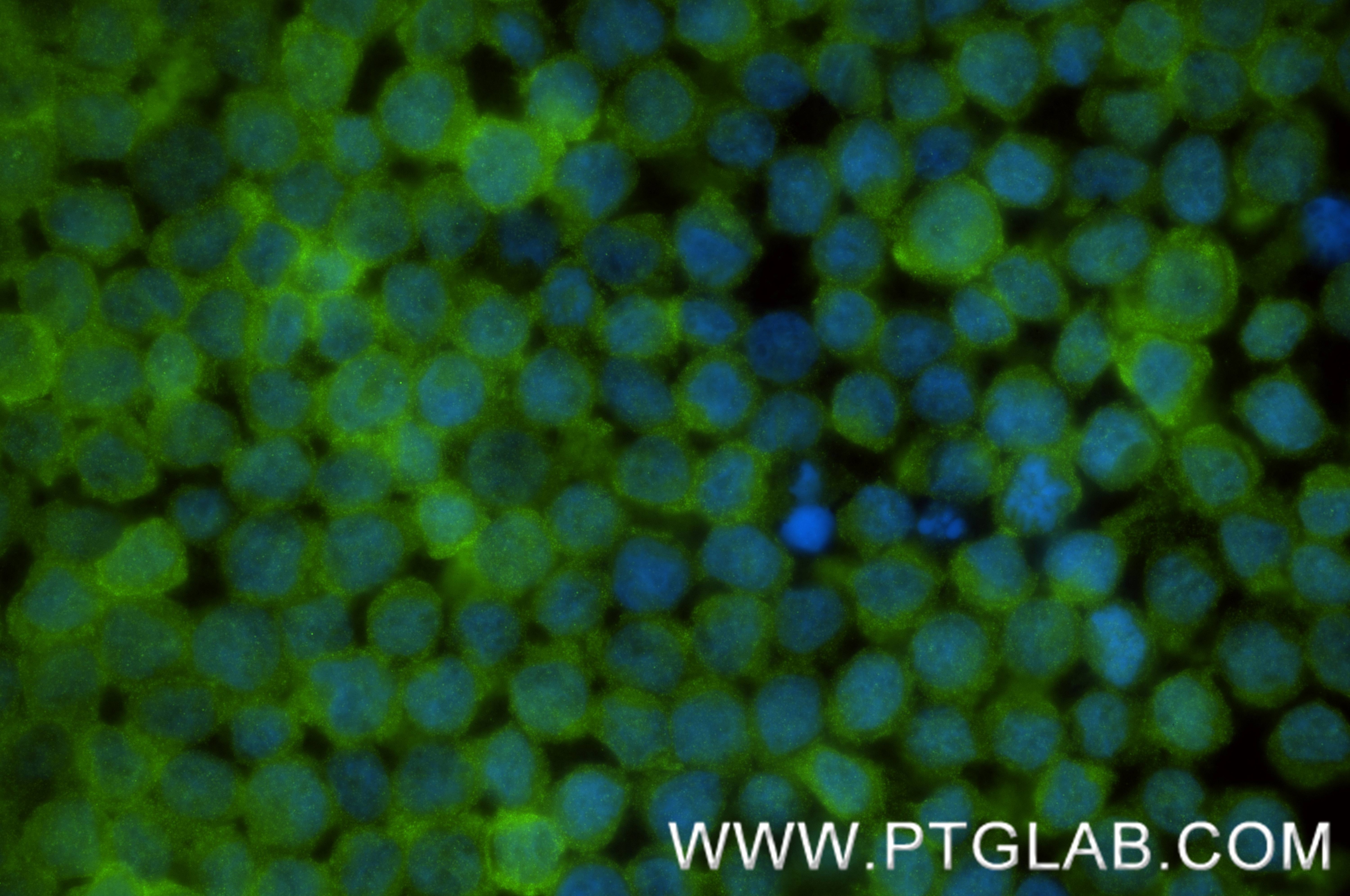 Immunofluorescence (IF) / fluorescent staining of THP-1 cells using RIPK3 Recombinant monoclonal antibody (86568-2-RR)