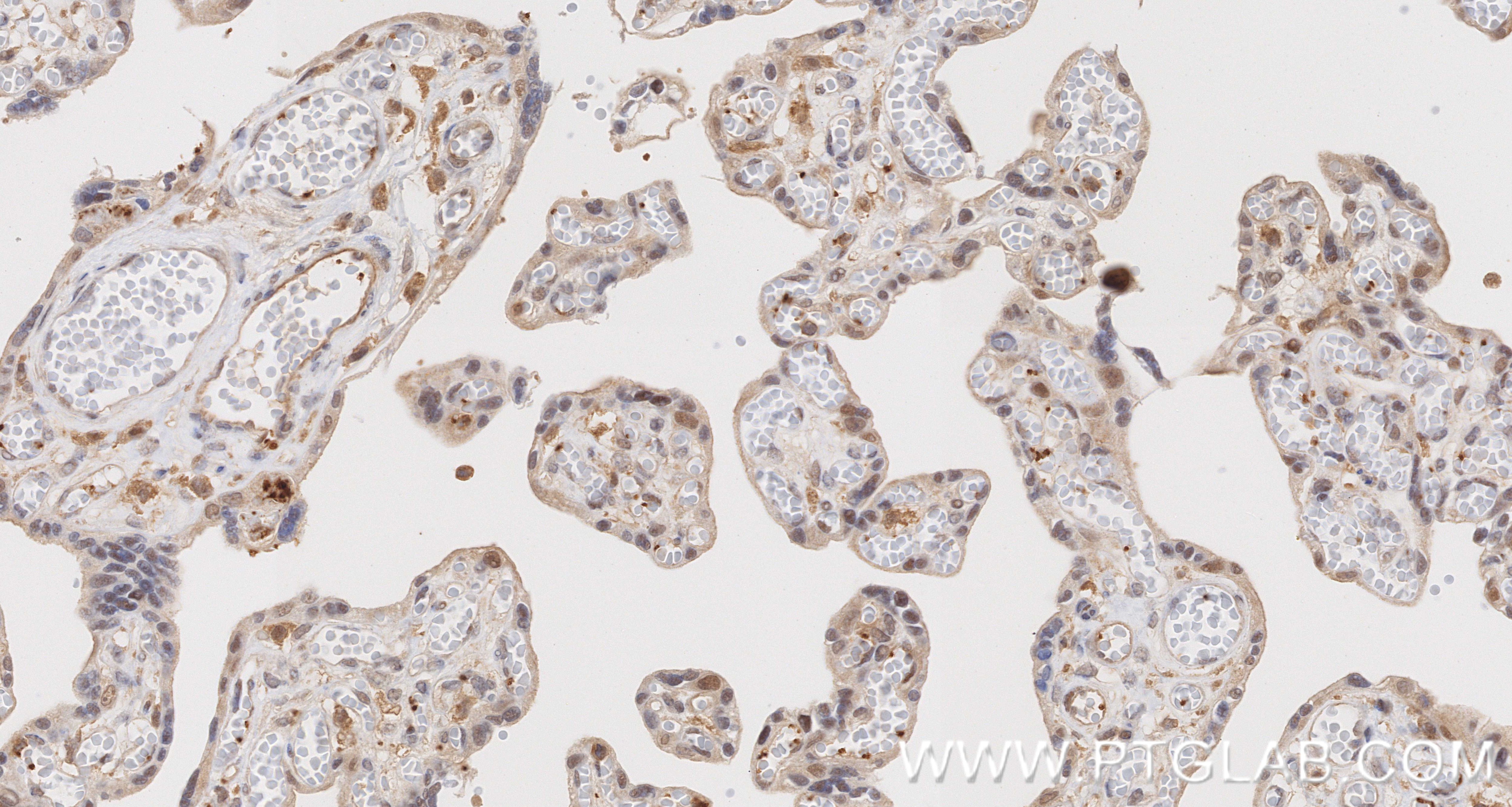 Immunohistochemistry (IHC) staining of human placenta tissue using RIPK3 Recombinant monoclonal antibody (86568-2-RR)