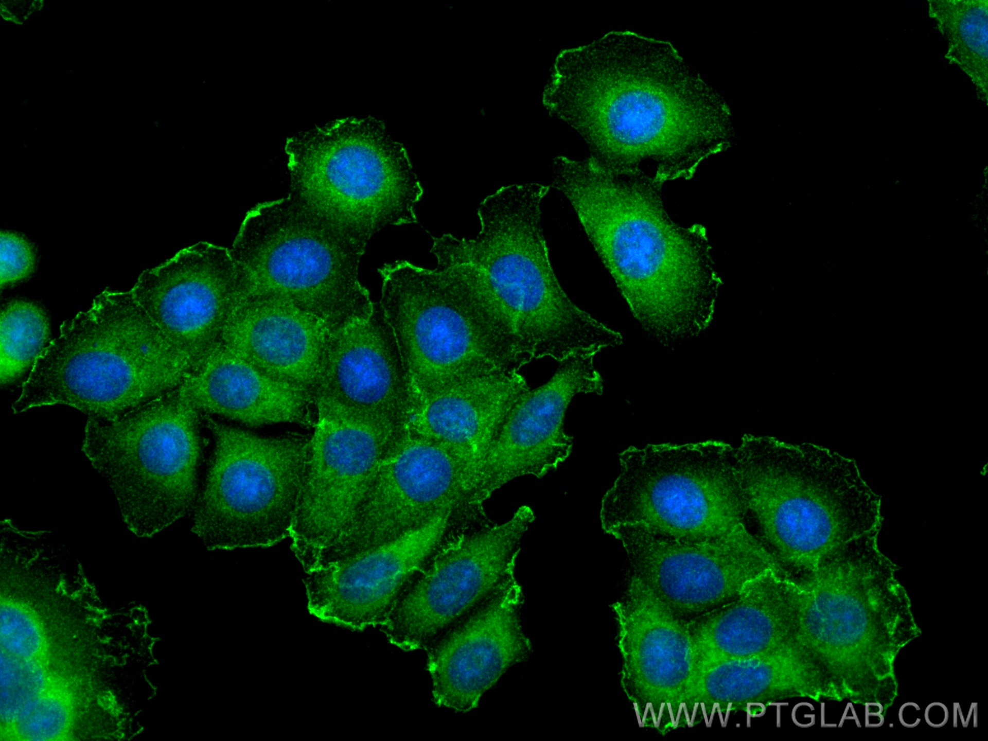 Immunofluorescence (IF) / fluorescent staining of MCF-7 cells using RIT1 Polyclonal antibody (26977-1-AP)