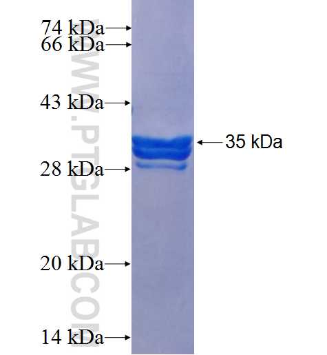RIT1 fusion protein Ag25636 SDS-PAGE