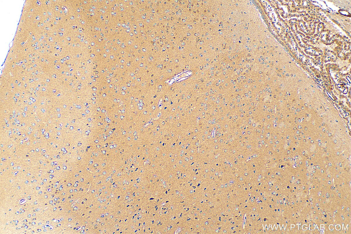 Immunohistochemistry (IHC) staining of mouse brain tissue using RIT2 Polyclonal antibody (12473-1-AP)