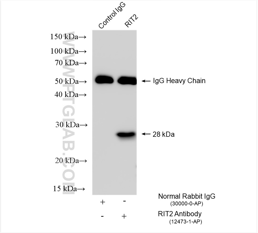 Immunoprecipitation (IP) experiment of mouse brain tissue using RIT2 Polyclonal antibody (12473-1-AP)