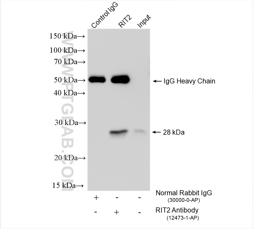 Immunoprecipitation (IP) experiment of rat brain tissue using RIT2 Polyclonal antibody (12473-1-AP)