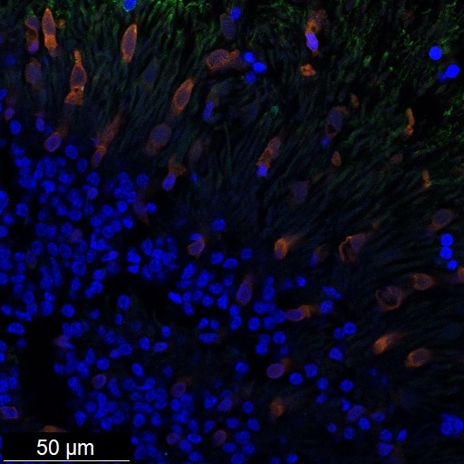 Immunofluorescence (IF) / fluorescent staining of Retinal organoids using RLBP1 Polyclonal antibody (15356-1-AP)
