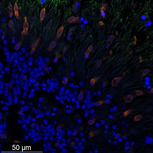 IF Staining of Retinal organoids using 15356-1-AP