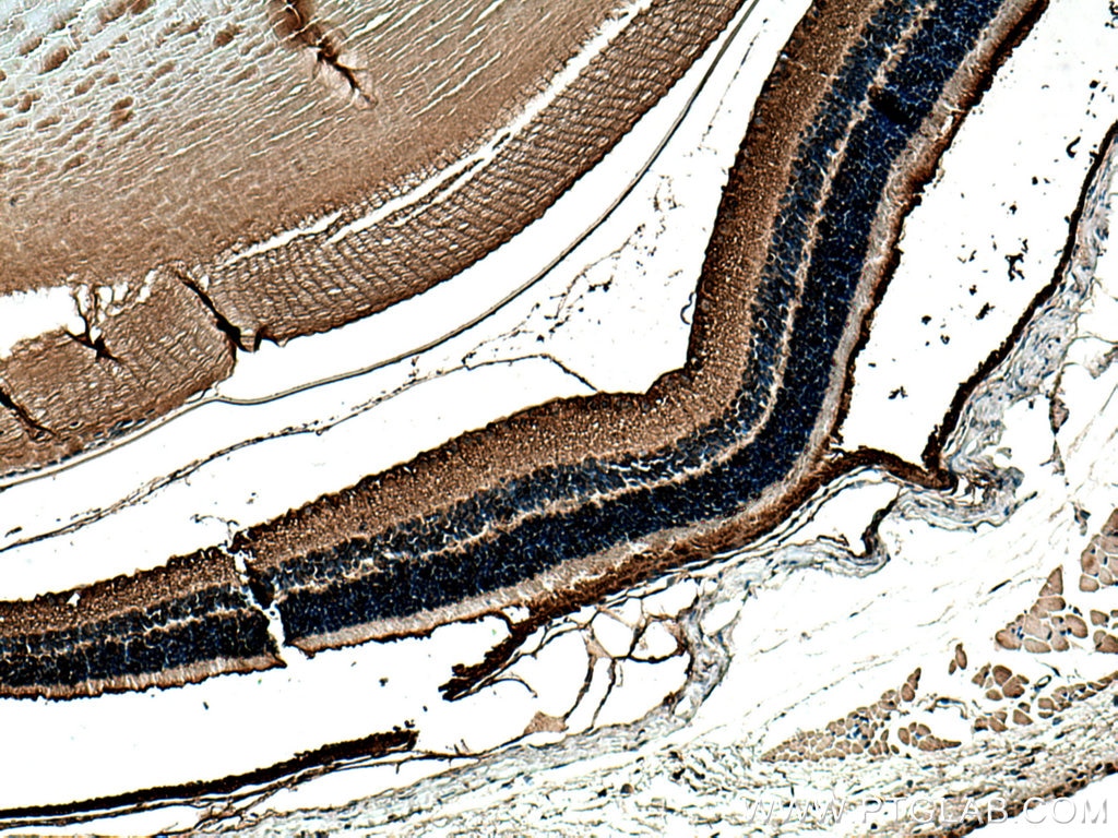 Immunohistochemistry (IHC) staining of mouse eye tissue using RLBP1 Polyclonal antibody (15356-1-AP)