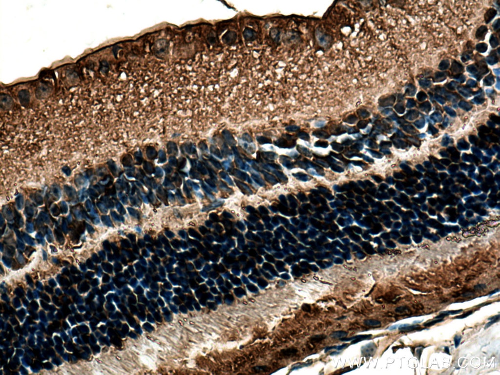 Immunohistochemistry (IHC) staining of mouse eye tissue using RLBP1 Polyclonal antibody (15356-1-AP)