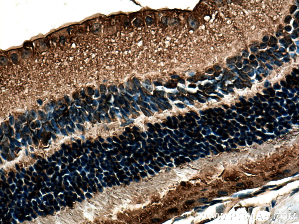 IHC staining of mouse eye using 15356-1-AP