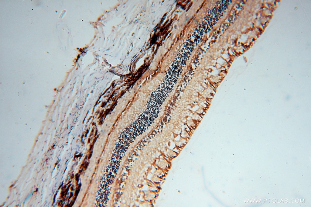 Immunohistochemistry (IHC) staining of human eye tissue using RLBP1 Polyclonal antibody (15356-1-AP)