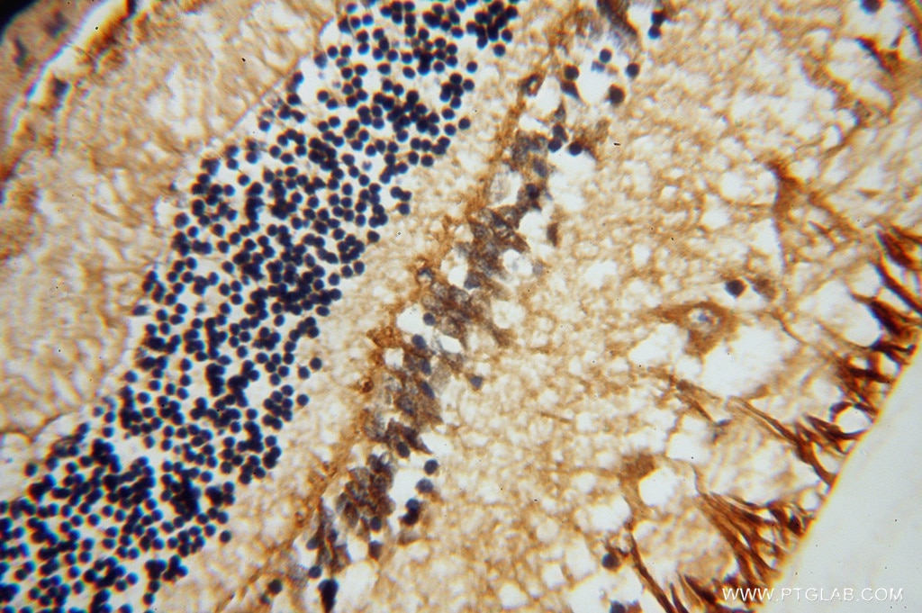Immunohistochemistry (IHC) staining of human eye tissue using RLBP1 Polyclonal antibody (15356-1-AP)